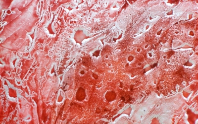BR009